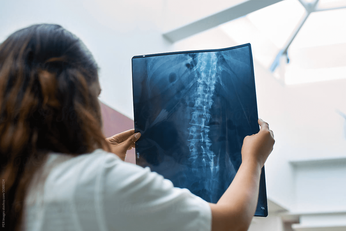Spinal Disk Recovery: 10 Proven Tips for a Faster, Pain-Free Life