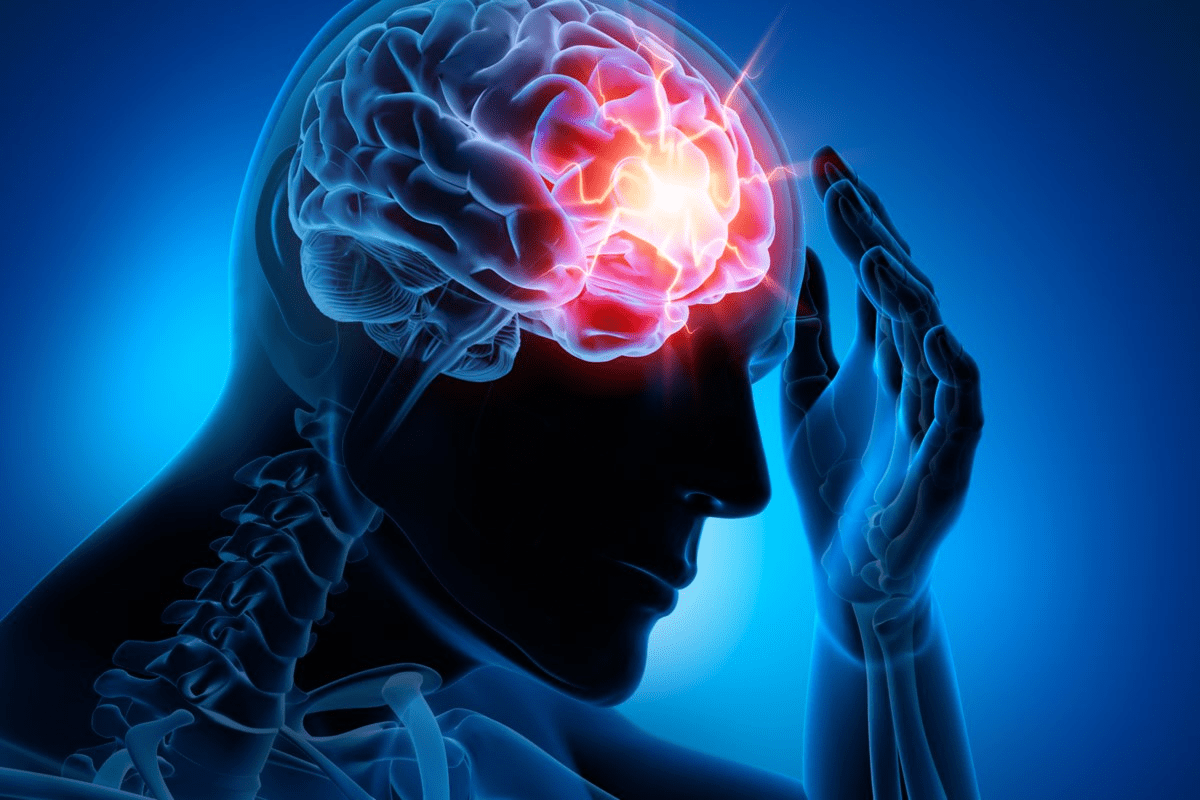 Define Pain Levels After Craniotomy Pain