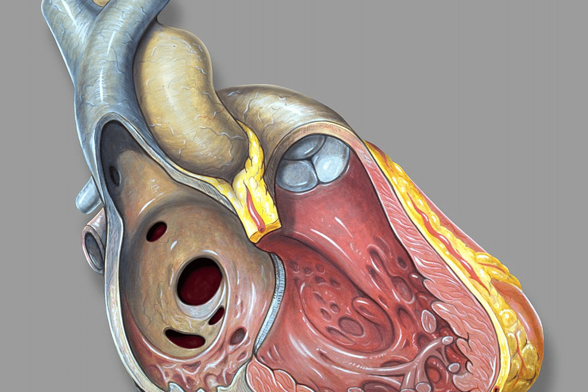 Key Natural Ways to Remove Plaque from Carotid Artery Stenosis