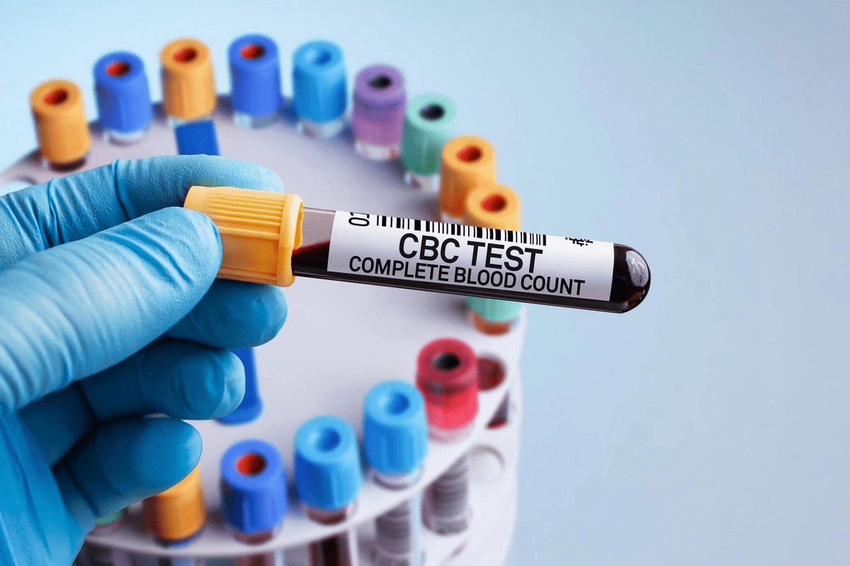 CBC blood test: An amazing, essential health tool