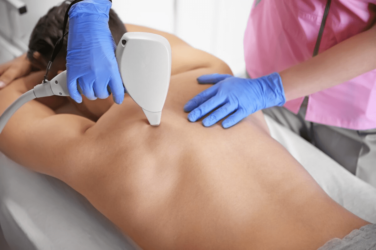 Laser Skin Resurfacing Before and After: Results Guide