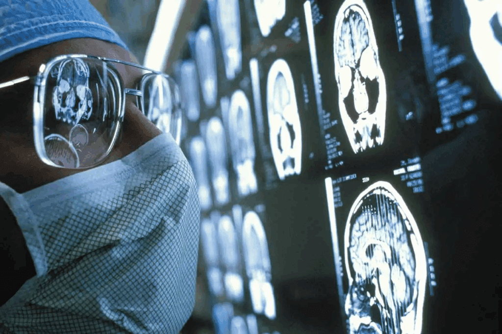 Key Aneurysm Clipping Recovery Time