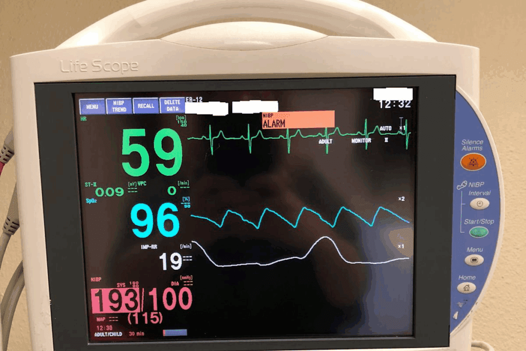 What Is a Heart Ablation & Why Monitoring Is Vital