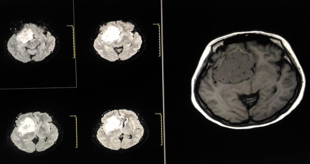 image 77 LIV Hospital