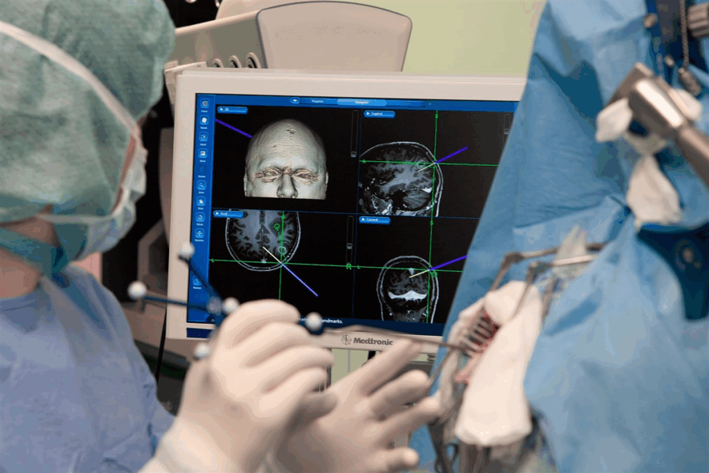 Define Endoscopic Brain Surgery Procedure