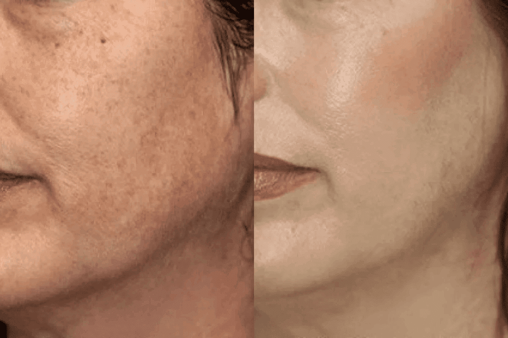 Face changes after chemo: The surprising truth