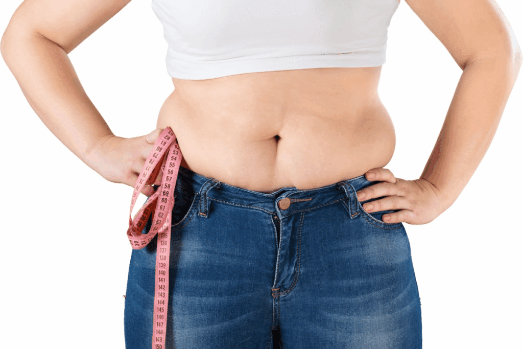 Ariatric Surgery Regret Reasons