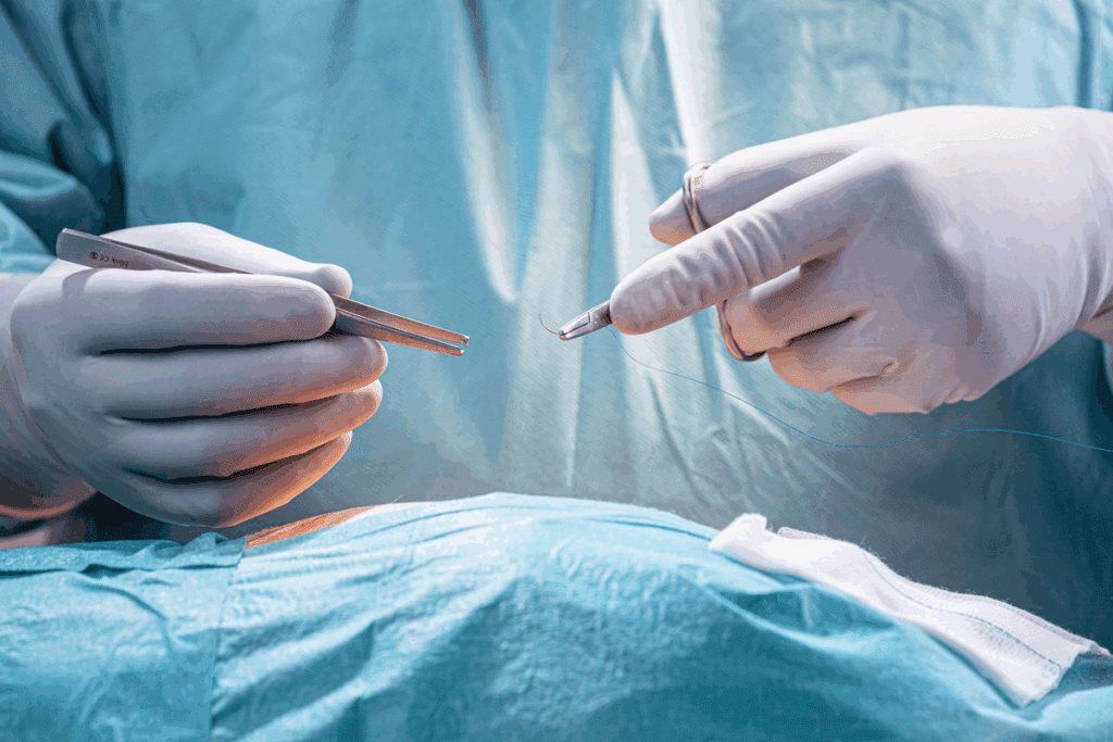 Gastrointestinal Surgery: Why Needed
