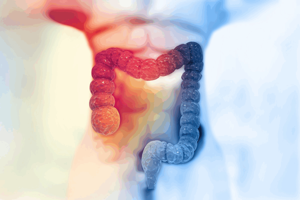 Bowel Resection Done Laparoscopically: Benefits & Procedure