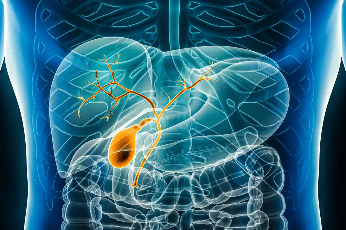 Four F's Gallbladder: Risk Factors Explained