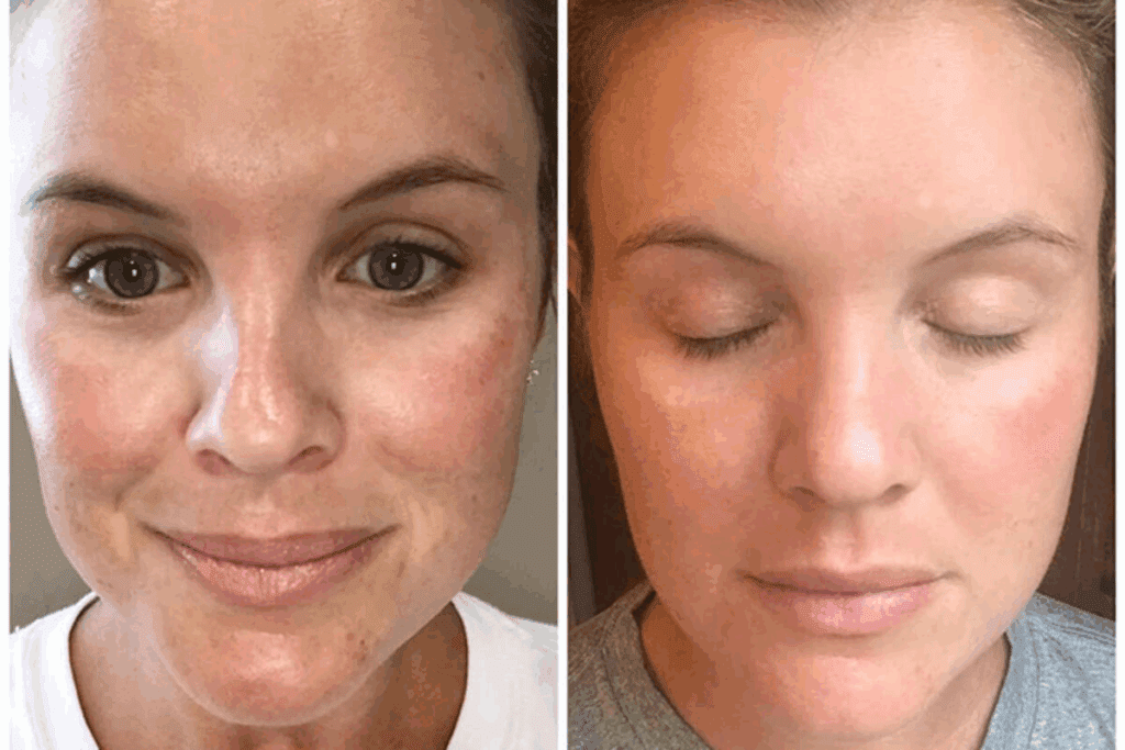 Face changes after chemo: The surprising truth