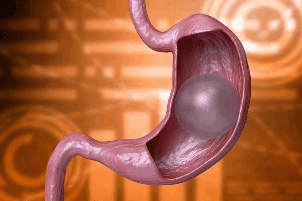 What Does a Mastectomy Scar Look Like?