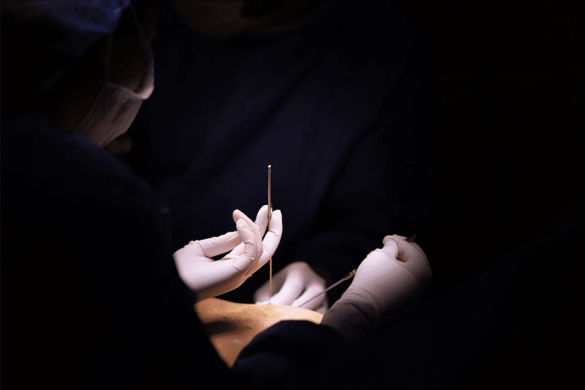 Radiation Hair Loss: The Surprising Truth