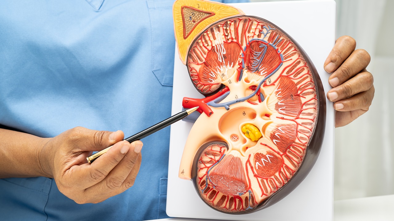 Stage 3 Kidney Disease
