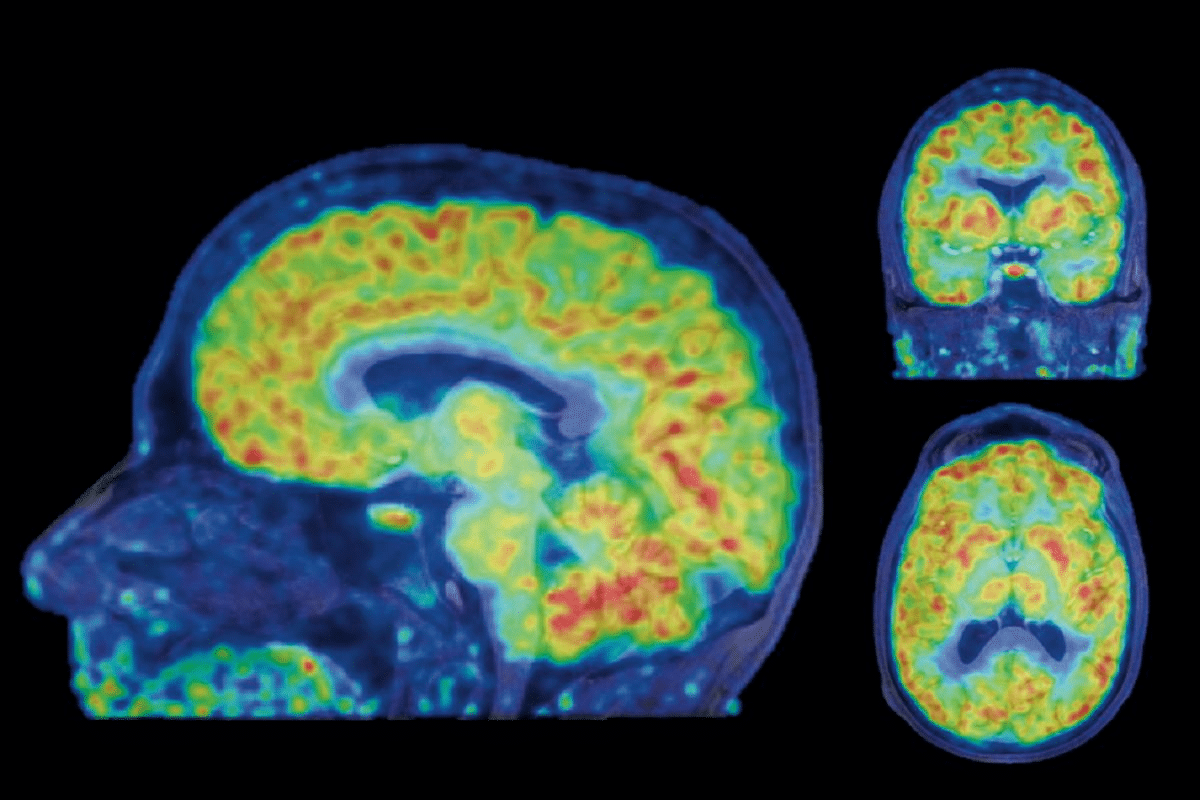 How Long Does an MRI Take: Understanding Scan Duration