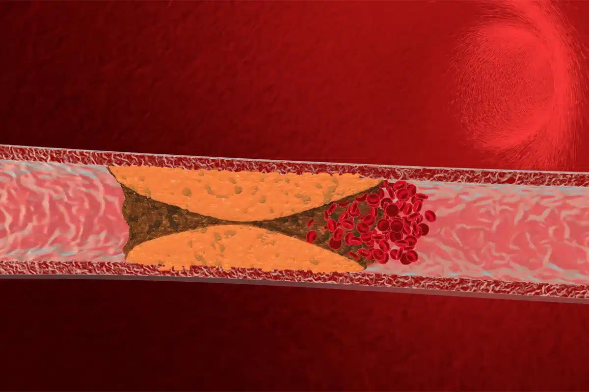 Blood Circulation Assessment Signs: Easy Check