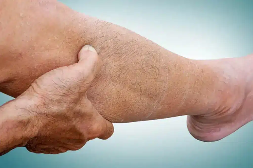 Common PAD Symptoms: Top Warning Signs